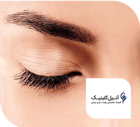 کلینیک تخصصی پوست، مو و زیبایی آنیل